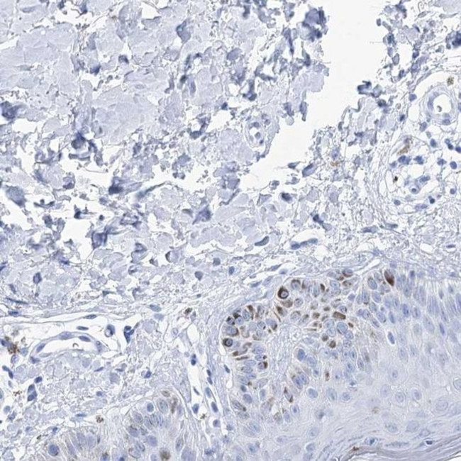 LALBA Antibody in Immunohistochemistry (IHC)