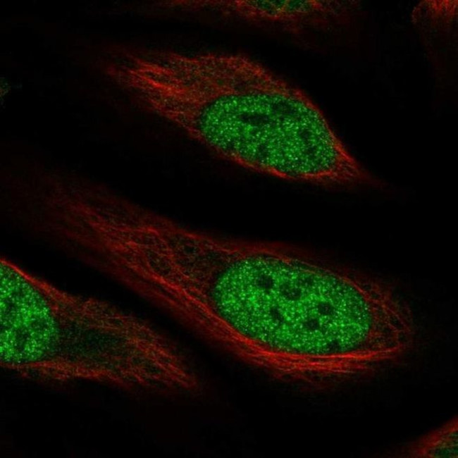 RHBDL1 Antibody in Immunocytochemistry (ICC/IF)