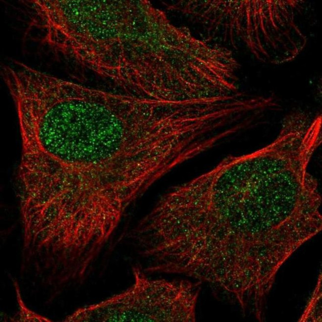 RAD54L2 Antibody in Immunocytochemistry (ICC/IF)