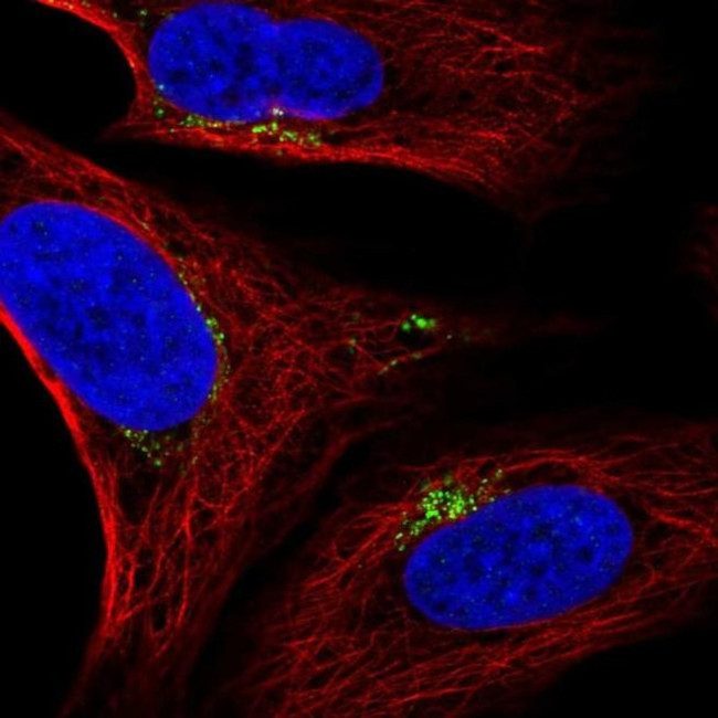 SPATA25 Antibody in Immunocytochemistry (ICC/IF)