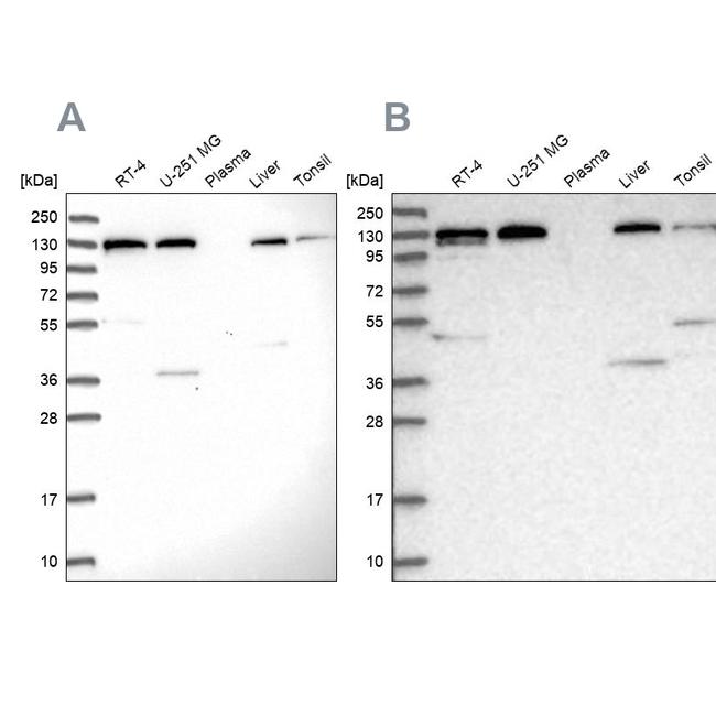 SEC23IP Antibody in Western Blot (WB)