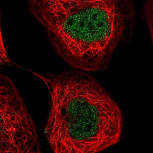 NUDT2 Antibody in Immunocytochemistry (ICC/IF)