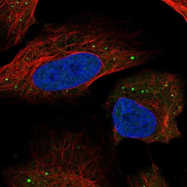 HSD11B1L Antibody in Immunocytochemistry (ICC/IF)