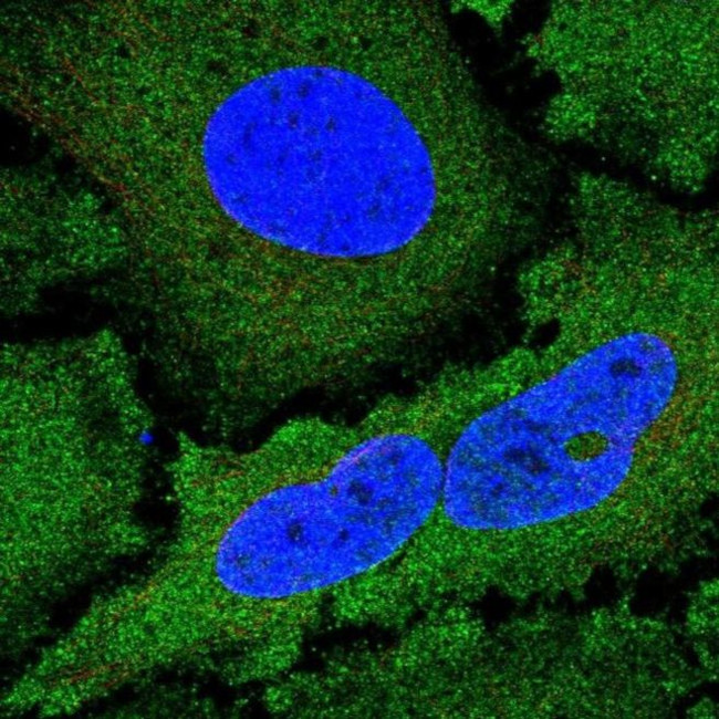 NCKIPSD Antibody in Immunocytochemistry (ICC/IF)