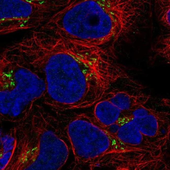 BLOC1S3 Antibody in Immunocytochemistry (ICC/IF)