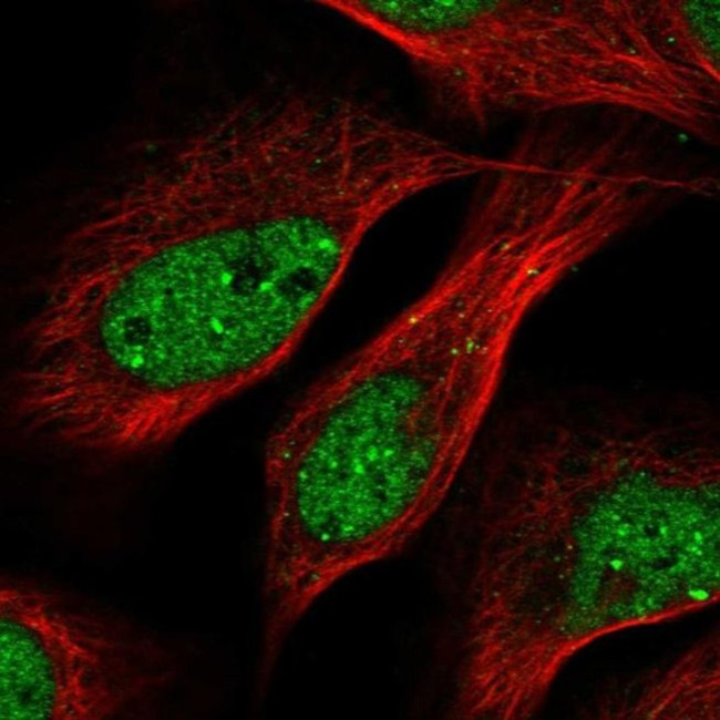 ASC1 Antibody in Immunocytochemistry (ICC/IF)