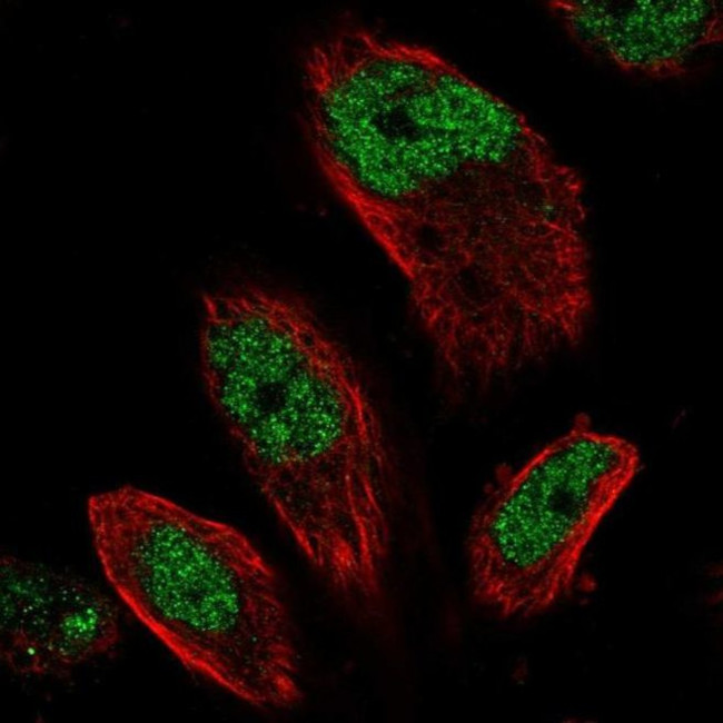 C11orf30 Antibody in Immunocytochemistry (ICC/IF)