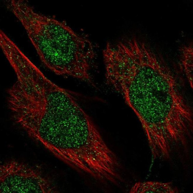 CAMTA2 Antibody in Immunocytochemistry (ICC/IF)