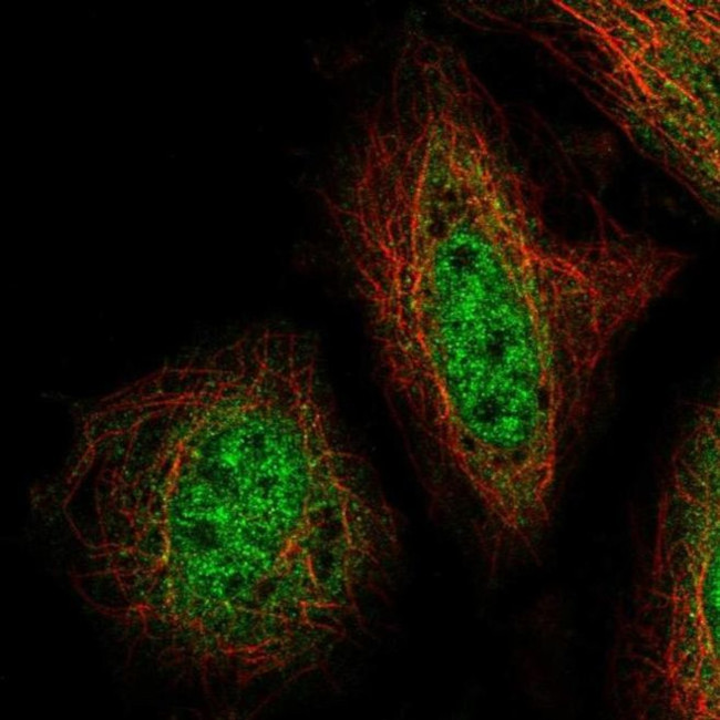 ZNF34 Antibody in Immunocytochemistry (ICC/IF)