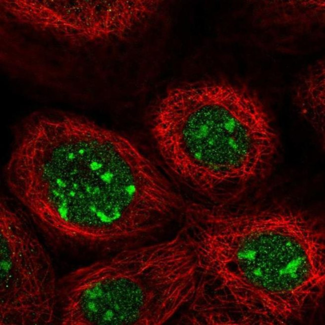 GPATCH4 Antibody in Immunocytochemistry (ICC/IF)