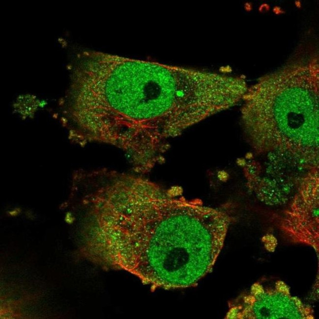 GPATCH3 Antibody in Immunocytochemistry (ICC/IF)