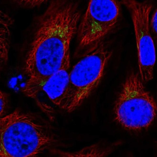 SPCS1 Antibody in Immunocytochemistry (ICC/IF)