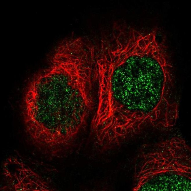 TBRG1 Antibody in Immunocytochemistry (ICC/IF)