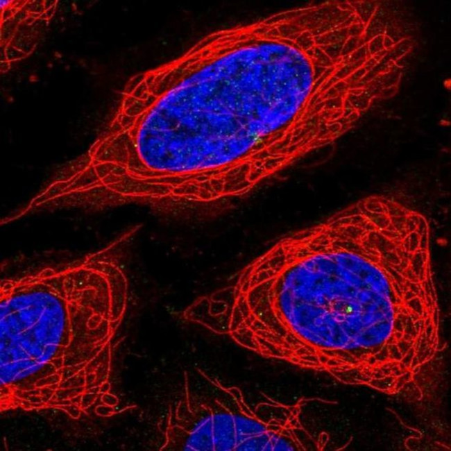 ADPGK Antibody in Immunocytochemistry (ICC/IF)