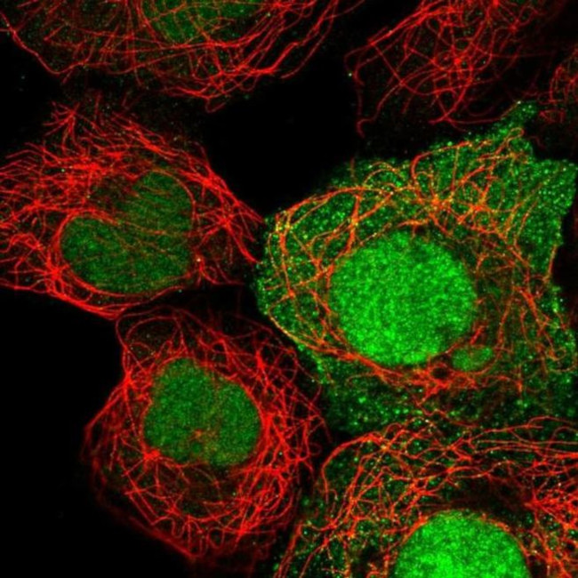 HEATR3 Antibody in Immunocytochemistry (ICC/IF)