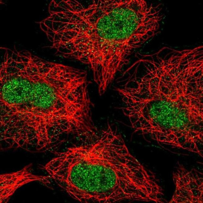 ZNF618 Antibody in Immunocytochemistry (ICC/IF)