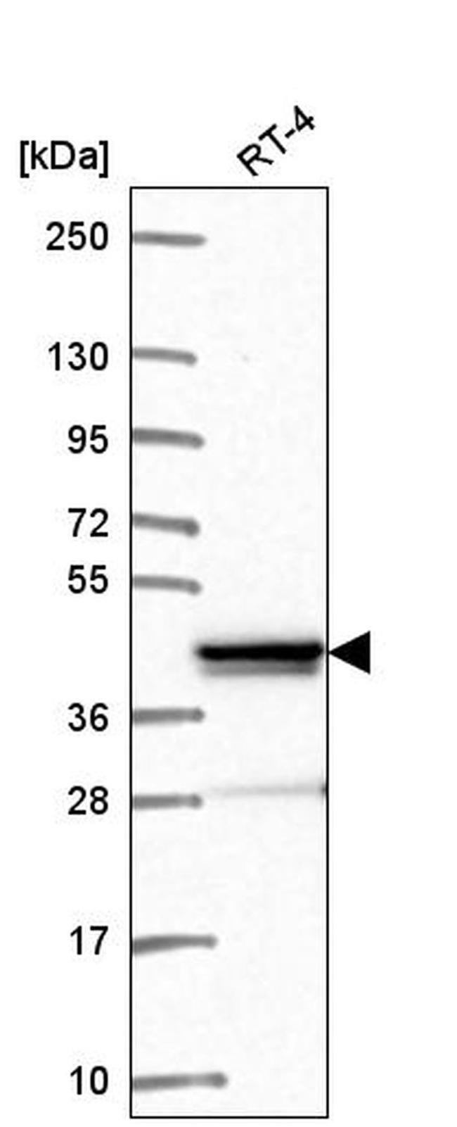 ZNF618 Antibody in Western Blot (WB)