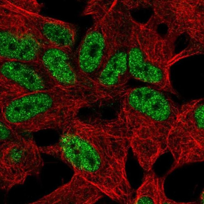 TLX2 Antibody in Immunocytochemistry (ICC/IF)