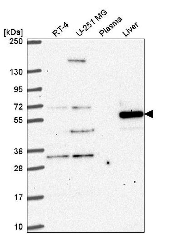 FAM116A Antibody in Western Blot (WB)