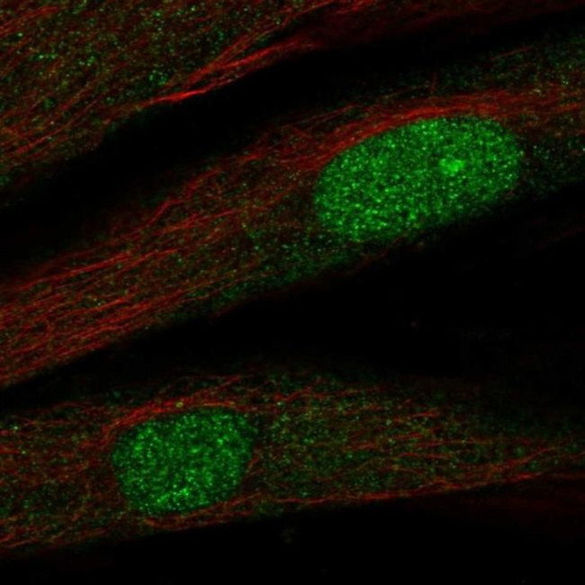 TWIST2 Antibody in Immunocytochemistry (ICC/IF)