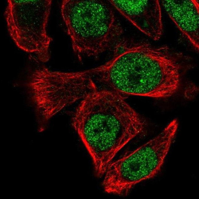 PUS3 Antibody in Immunocytochemistry (ICC/IF)