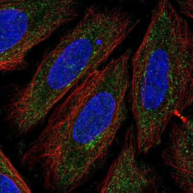 TTPAL Antibody in Immunocytochemistry (ICC/IF)