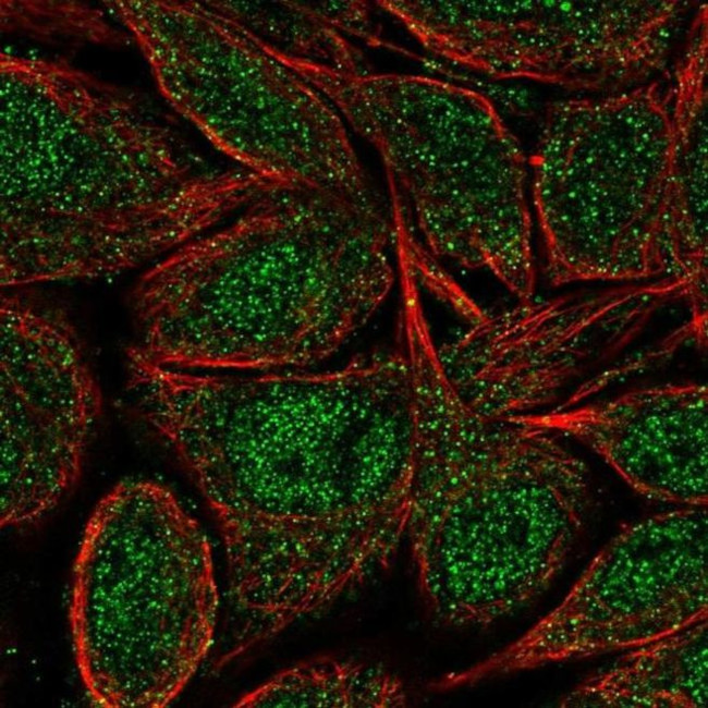 ZNF34 Antibody in Immunocytochemistry (ICC/IF)