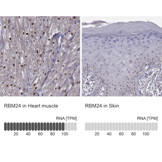RBM24 Antibody in Immunohistochemistry (IHC)