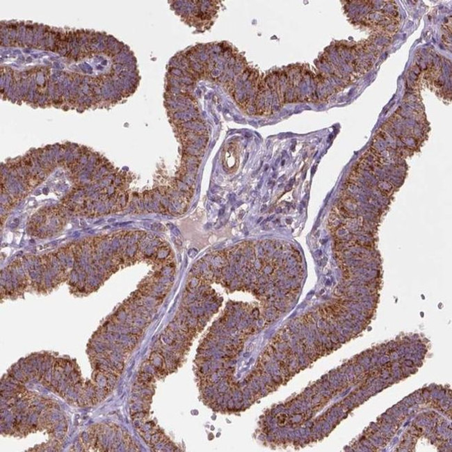 WARS2 Antibody in Immunohistochemistry (IHC)