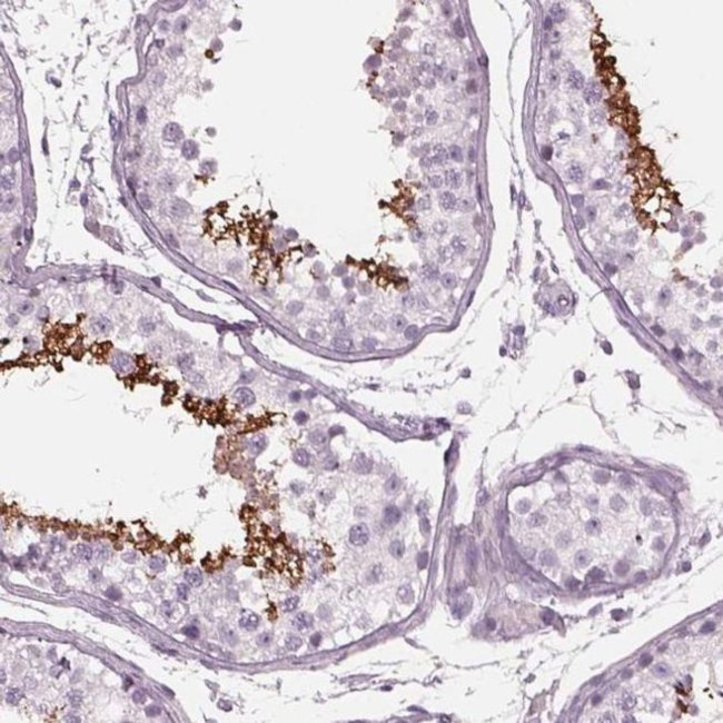 CYLC1 Antibody in Immunohistochemistry (IHC)