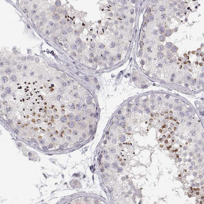 FAM205A Antibody in Immunohistochemistry (IHC)