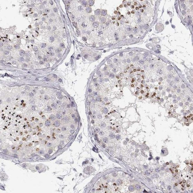 FAM205A Antibody in Immunohistochemistry (IHC)