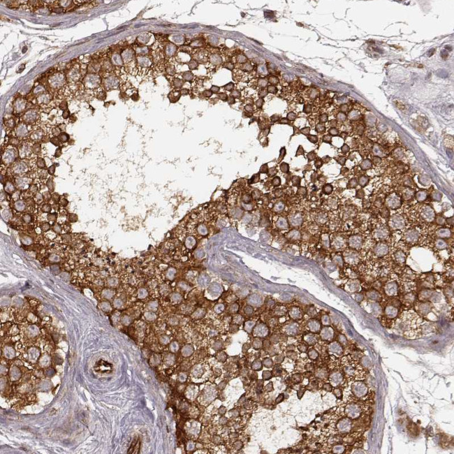 AGPAT1 Antibody in Immunohistochemistry (Paraffin) (IHC (P))