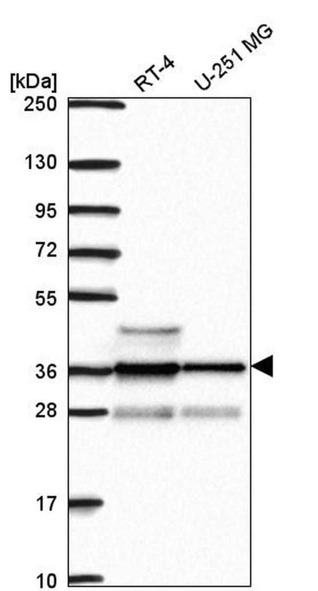 RNF34 Antibody in Western Blot (WB)