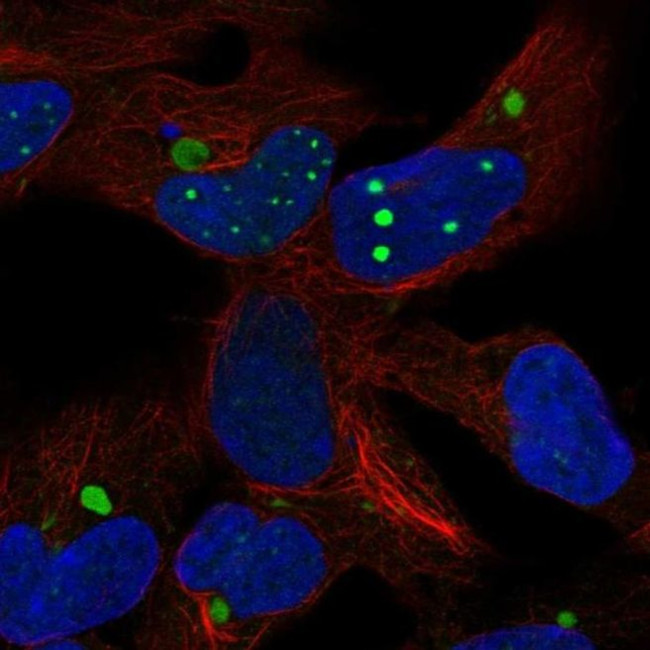 HEY2 Antibody in Immunocytochemistry (ICC/IF)