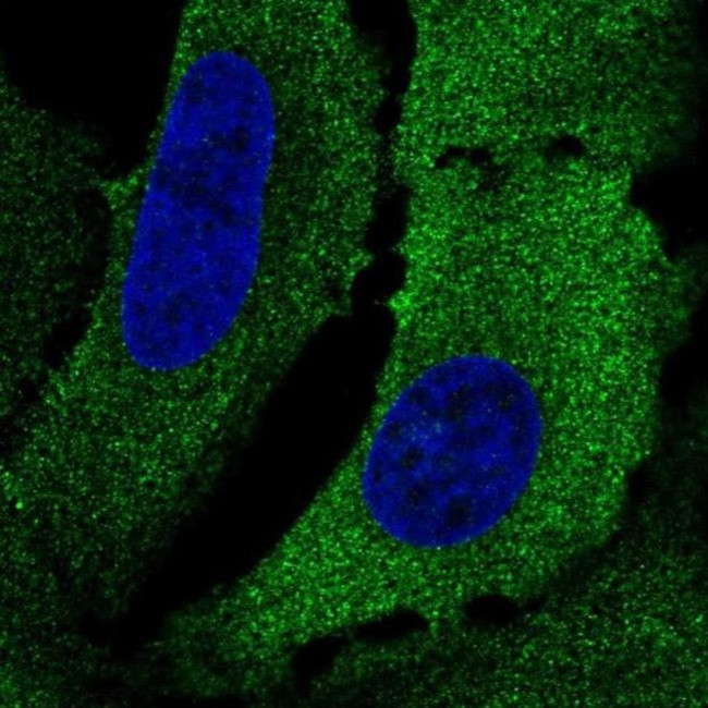 KRT75 Antibody in Immunocytochemistry (ICC/IF)