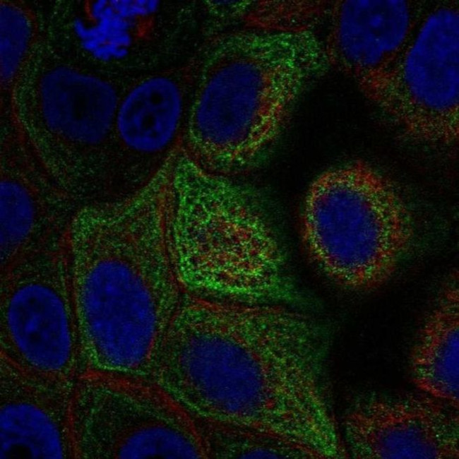 Adenylate Cyclase 5 Antibody in Immunocytochemistry (ICC/IF)