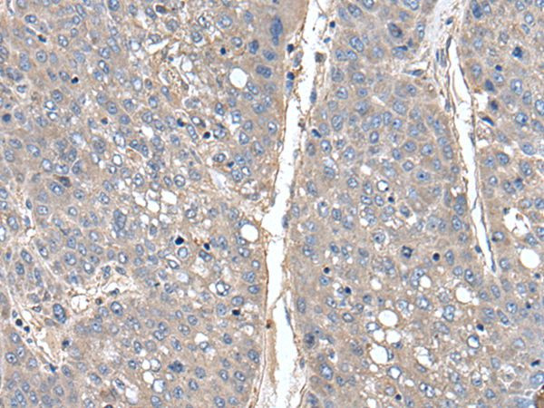 THAP10 Antibody in Immunohistochemistry (Paraffin) (IHC (P))