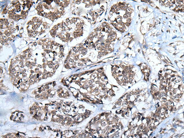 WEE1 Antibody in Immunohistochemistry (Paraffin) (IHC (P))