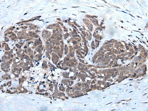 WEE1 Antibody in Immunohistochemistry (Paraffin) (IHC (P))