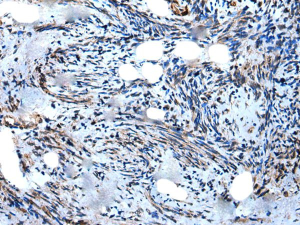 WIPF1 Antibody in Immunohistochemistry (Paraffin) (IHC (P))