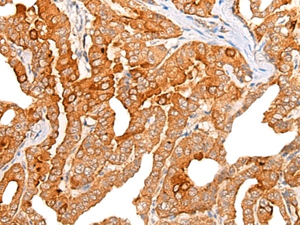 Chordin Antibody in Immunohistochemistry (Paraffin) (IHC (P))