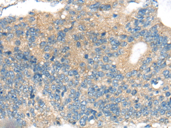 CNTNAP1 Antibody in Immunohistochemistry (Paraffin) (IHC (P))