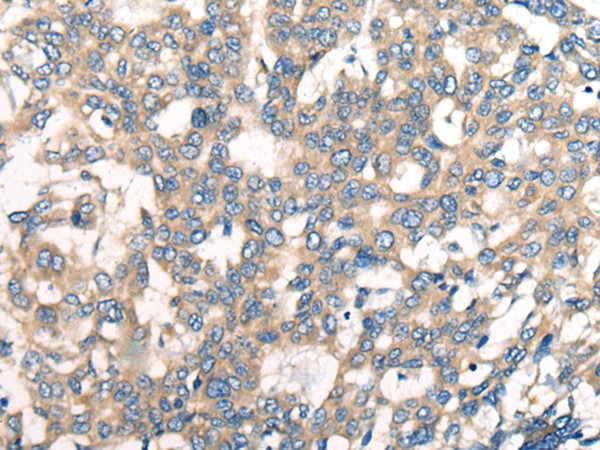 CNTNAP1 Antibody in Immunohistochemistry (Paraffin) (IHC (P))