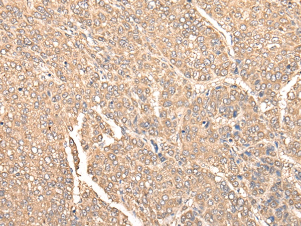 FENS1 Antibody in Immunohistochemistry (Paraffin) (IHC (P))