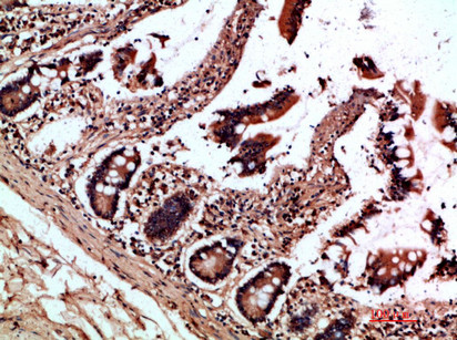 Oncostatin M Antibody in Immunohistochemistry (Paraffin) (IHC (P))