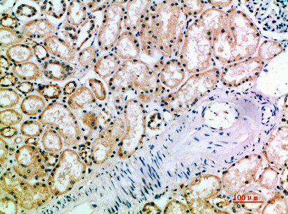 KIR3DL2 Antibody in Immunohistochemistry (Paraffin) (IHC (P))