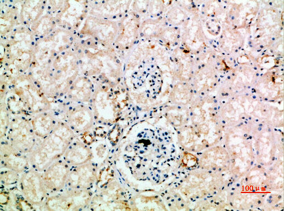 IL18RAP Antibody in Immunohistochemistry (Paraffin) (IHC (P))