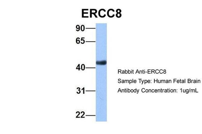 ERCC8 Antibody in Western Blot (WB)