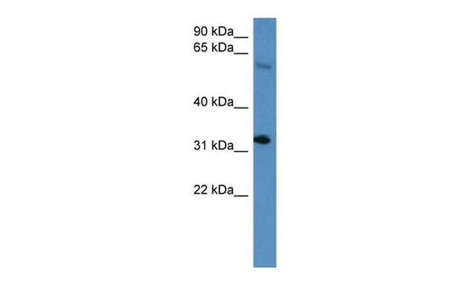 HOXD13 Antibody in Western Blot (WB)